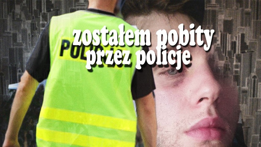 Policjanci brutalnie pobili 19-latka? To popularny Youtuber