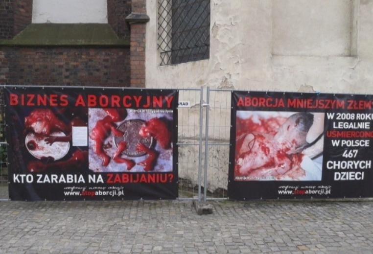 Zdjęcia rozczłonkowanych płodów znów publicznie zostaną...