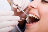 Najlepszy dentysta w woj. lubuskim. Tych stomatologów polecają pacjenci z naszego regionu - ranking 5.06.2020