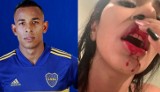 Skandal w Argentynie. Piłkarz Sebastian Villa pobił swoją dziewczynę? Daniela Cortes pokazała obrażenia [ZDJĘCIA]
