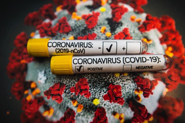 GiS podał nowe kryteria odnośnie definicji zakażenia koronawirusem.