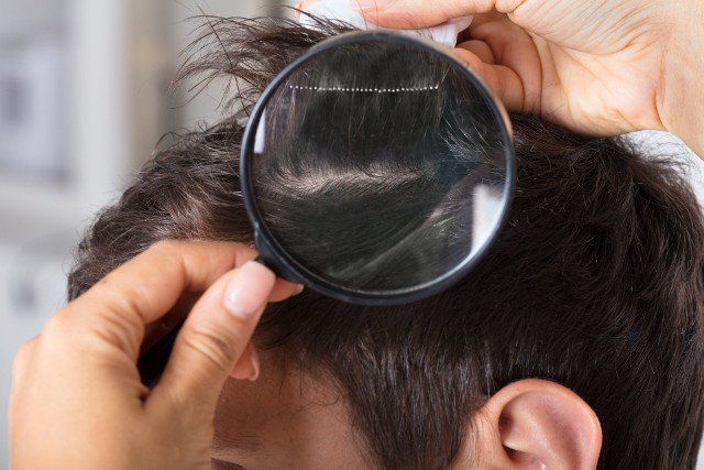 Jedną z metod sprawdzania, czy we włosach nie ma gnid (jaj wszy) oraz wszy, a także ich usuwania, jest czesanie włosów za pomocą specjalnego, gęstego grzebienia.