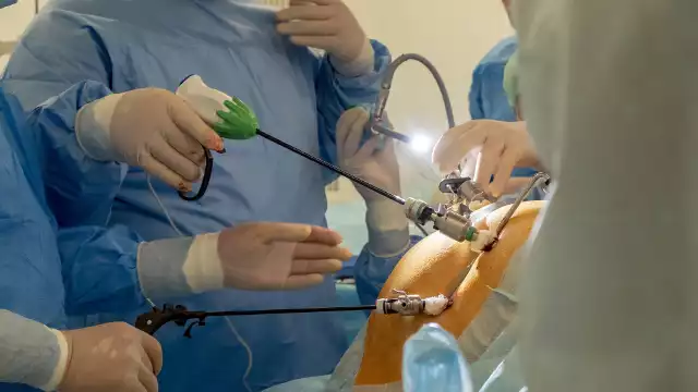 Na początku laparoskopii w jamie brzusznej wytwarza się odpowiednią przestrzeń. Dzięki niej chirurg ma możliwość manewrowania narzędziami w celu przeprowadzenia zbiegu operacyjnego. Aby wytworzyć tę przestrzeń, do jamy brzusznej wprowadza się igłę odmową, przez którą wpompowany zostaje gaz (najczęściej dwutlenek węgla).