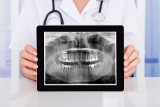 Pantomogram, czyli rentgen zębów. Kiedy wykonuje się zdjęcie pantomograficzne i jakie są przeciwwskazania do badania?