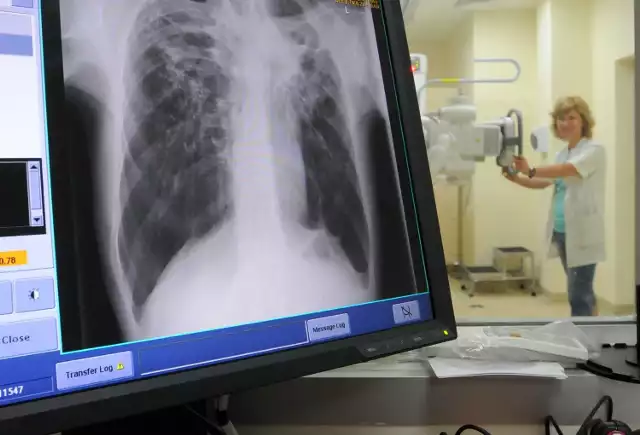 Choroby płuc i gruźlica to poważny problem zdrowotny mieszkańców Lubelszczyzny od wielu lat