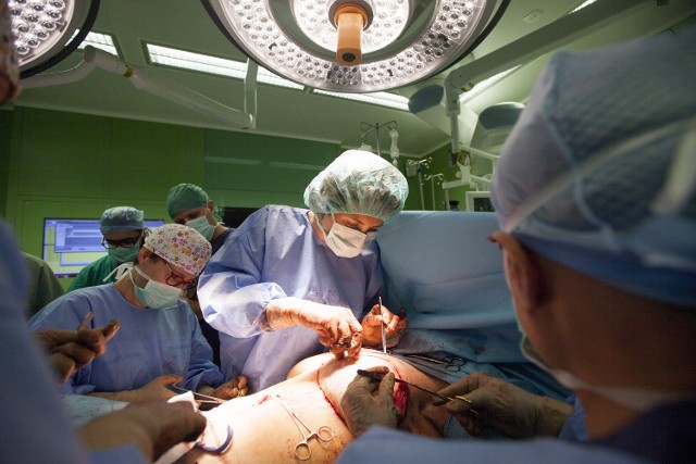 Zabieg mastektomii rekonstrukcji piersi przeprowadzany w Szpitalu Uniwersyteckim w Krakowie