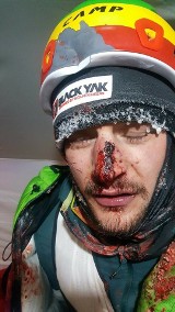 Adam Bielecki miał wypadek na K2. Kamień spadł mu na twarz, polski himalaista musiał wrócić do bazy