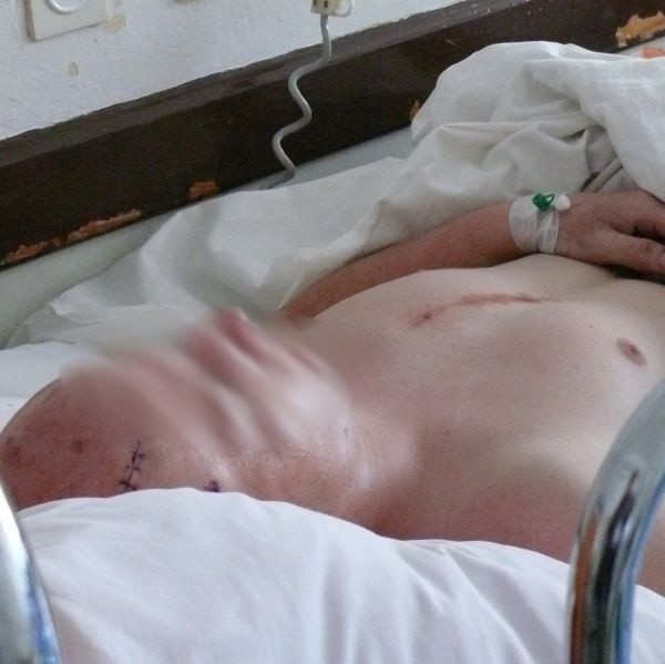 Poszkodowany 21-letni mężczyzna leży w szpitalu w Kozienicach. We wtorek niemal przez cały dzień był nieprzytomny.