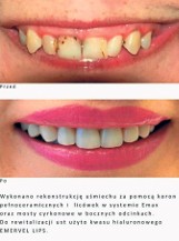 Laboratorium Pięknego Uśmiechu STOMATOLOGIA - nowoczesne techniki dentystyczne i stomatologia estetyczna [LIDERZY REGIONU 2019]