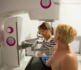 Wkrótce do Inowrocławia przyjedzie mammobus. Dzięki tym badaniom panie mogą uniknąć raka