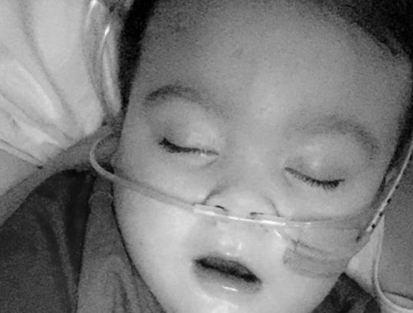 Alfie Evans nie żyje. Chłopiec zmarł w nocy 27.04.2018 [Przyczyny śmierci - Alfie Evans nie żyje]