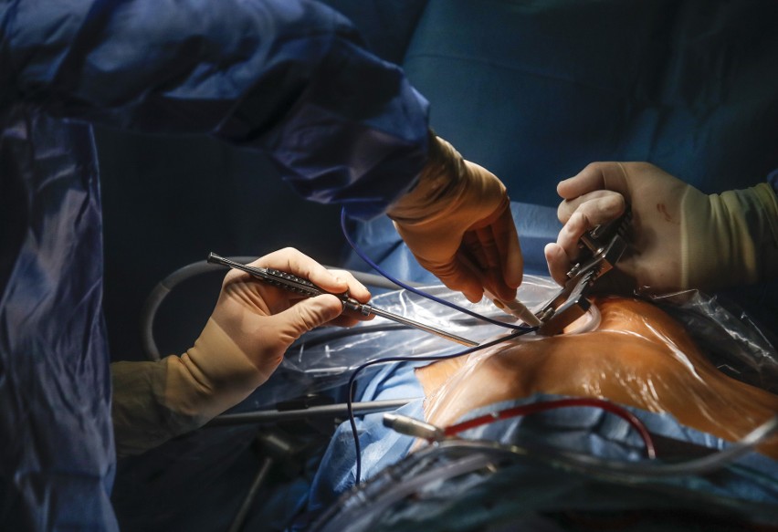 Pokazowy zabieg kardiochirurgiczny dla lekarzy z Arabii Saudyjskiej w Klinicznym Szpitalu Wojewódzkim nr 2 w Rzeszowie
