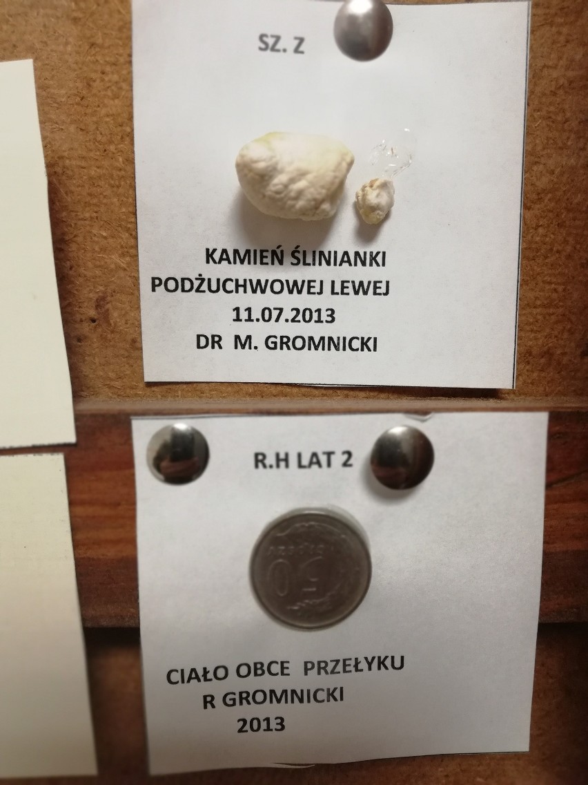 Jak mówi ordynator słupskiego oddziału laryngologii...