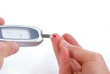 Reumatoidalne zapalenie stawów zwiększa ryzyko cukrzycy typu 2. Wyniki badania sugerują, że powodem jest zapalne podłoże obu chorób