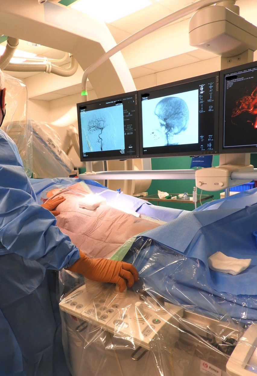 Neurochirurdzy z „Kopernika”: dzięki stentom nowej generacji operacje tętniaków mózgu są bardziej skuteczne i bezpieczne dla chorych