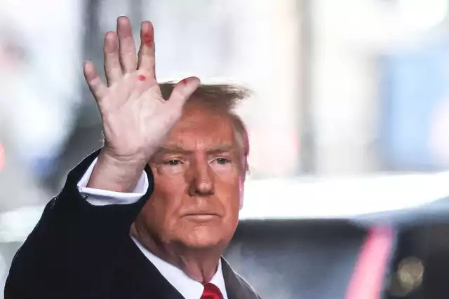 Czy Donald Trump wyjaśni przyczynę tajemniczych plam na jego dłoni?