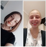 Poznań: Nastoletnia Zuza pokonała raka. Teraz chce być przykładem, by uświadamiać rówieśników