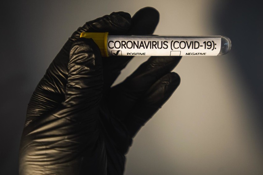  Gdańskie szpitale Copernicus przeprowadzają kwalifikacje dawców osocza dla chorych na COVID-19. Przebadanych zostanie 3 tys. ozdrowieńców