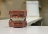 Sennik - zęby. Jakie jest znaczenie snów o zębach?