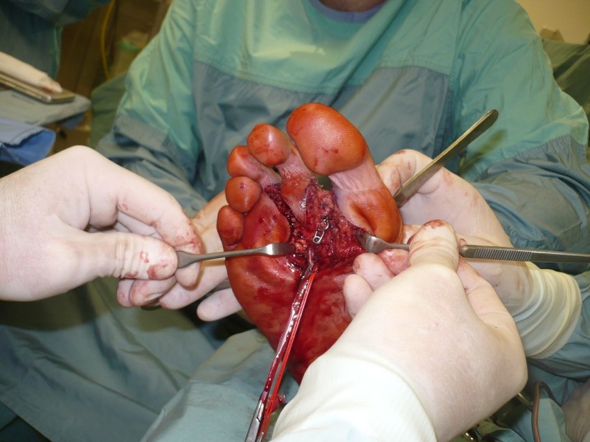 Zdjęcia z operacji