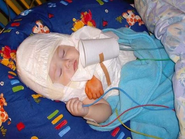 Półroczny Adaś kilka dni po operacji splotu ramiennego w Niemczech.
