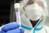 Testy antygenowe na obecność SARS-CoV-2 w aptekach. Czy trzeba będzie na nie mieć skierowanie?