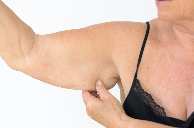 Obwisłe ramiona to problem wielu kobiet po pięćdziesiątce, ale nie tylko. Zobacz, co możesz zrobić, aby zniwelować ten defekt.