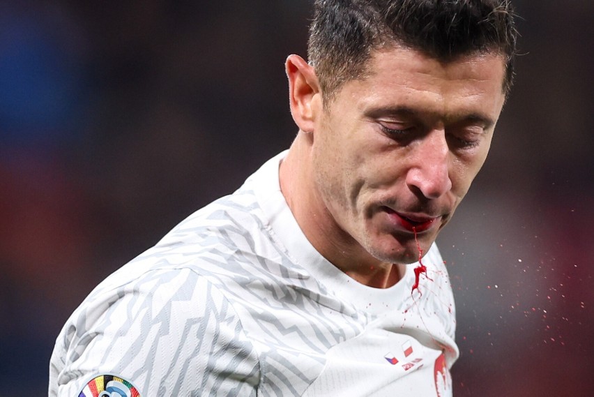 Robert Lewandowski pluł krwią podczas meczu Czechy - Polska. To skutek faulu