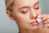 Krew z nosa u dziecka, osoby dorosłej, w ciąży – przyczyny i zasady postępowania. Jak zatamować krwotok z nosa?  