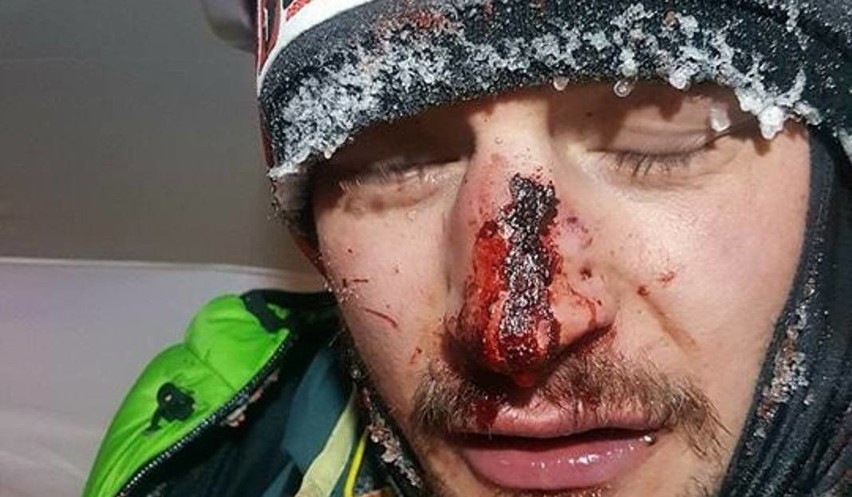Wypadek Adama Bieleckiego na K2: Na alpinistę spadł głaz. Adam Bielecki ma złamany nos. Czy zdobędzie szczyt K2?