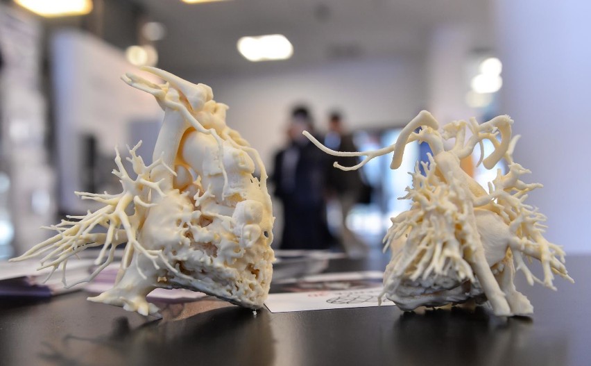 W Gdańskim Parku Naukowo-Technologicznym drukują serce w 3D. Pomaga ratować dzieci [zdjęcia]
