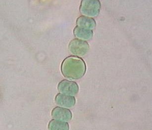 Kolonia sinic w powiększeniu.