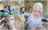 Szpital "Zdroje" w Szczecinie. Unikalna operacja korekcji czaszki u 5-letniej Tosi [ZDJĘCIA]