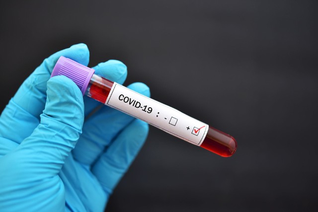 Znów spadła liczba wykonanych testów na koronawirusa w Polsce?