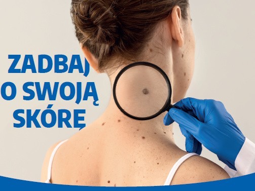 Bezpłatne badanie skóry odbędą się już 19 lipca przy ulicy Konopnickiej w Nowym Dworze Gd. Zbadać będzie się można w dermobusie