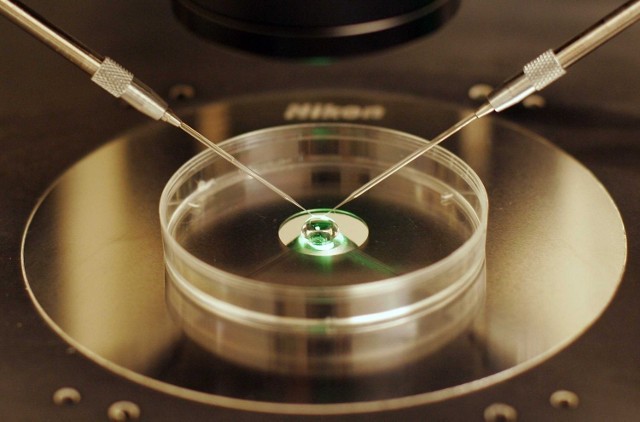 Cena in vitro, czyli zabiegu zapłodnienia pozustrojowego może spaść do poziomu kilkuset złotych, dzięki nowej metodzie