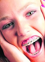 U ortodonty można się leczyć w każdym wieku