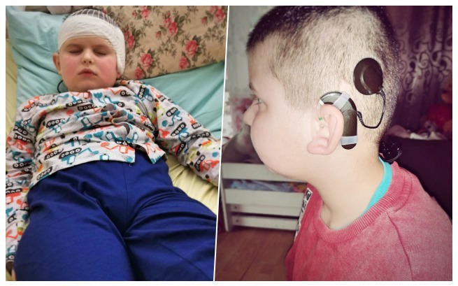 Ośmioletni Kamil Kosno jeszcze może usłyszeć świat. Potrzebuje naszej pomocy [ZDJĘCIA]  