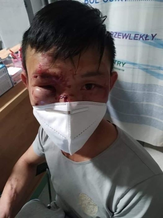 Brutalny atak na pracownika wietnamskiej restauracji w Jędrzejowie! Co stało się w nocy, 8 września? Policja bada sprawę [WIDEO]