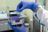 Testy PCR, serologiczne czy antygenowe - czym się różnią testy na koronawirusa? Poradnik dotyczący badań wirusa SARS-CoV-2