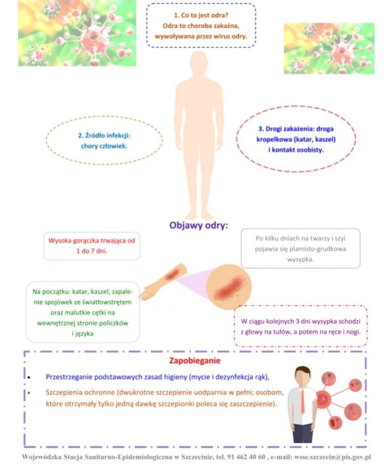 Groźna odra atakuje. Sanepid przygotował ulotki po rosyjsku i ukraińsku 