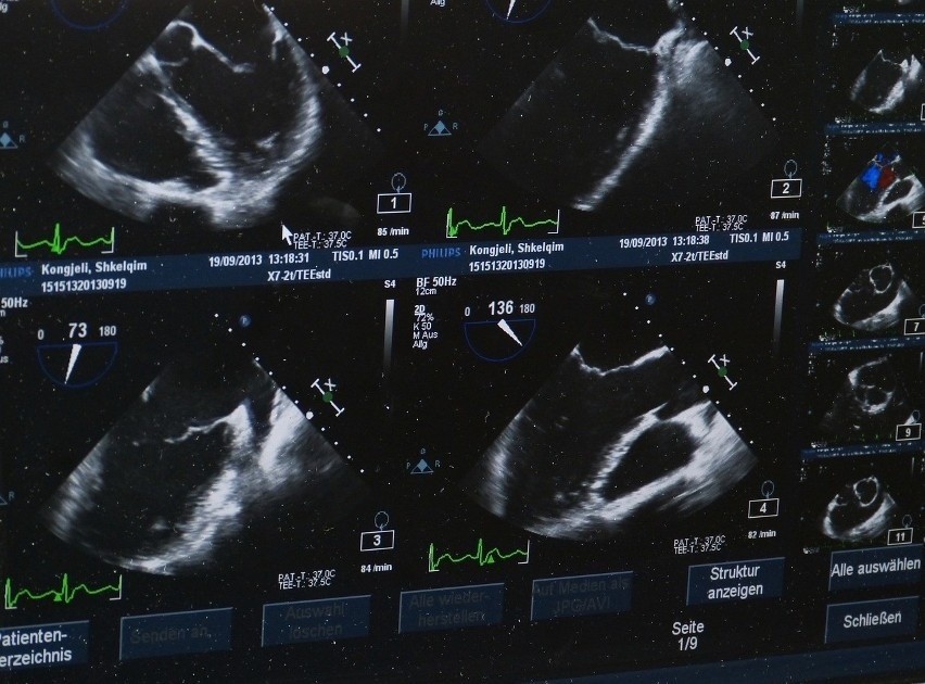 Gdzie wykonać USG? Tych radiologów polecają pacjenci >>>>