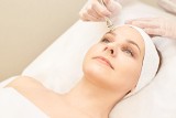 Zamykanie naczynek na twarzy laserem i metodą elektrokoagulacji – wskazania i przeciwwskazania. Jak postępować ze skórą poddaną zabiegowi?