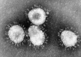 Wirus z Chin. Jakie są objawy koronawirusa? Chiny wprowadziły blokadę 11-milionowego miasta. Co to jest koronawirus i gdzie występuje? 