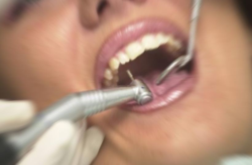 Gdzie do dentysty? W dentobusie przebadali 757 pacjentów w miesiącu. W naszym województwie pomysł się przyjął