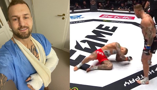 „Zombiak” Marcin Wrzosek po operacji złamanej ręki podczas pojedynku z Piotrem „Szelim” Szeligą na gali FAME MMA 17