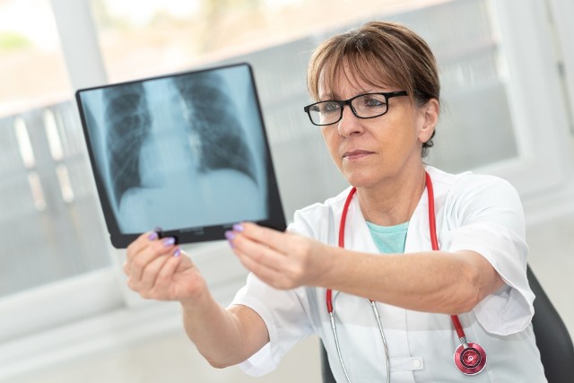 U pacjentów z POChP należy regularnie wykonywać RTG płuc, aby sprawdzić poziom uszkodzeń miąższu narządów.