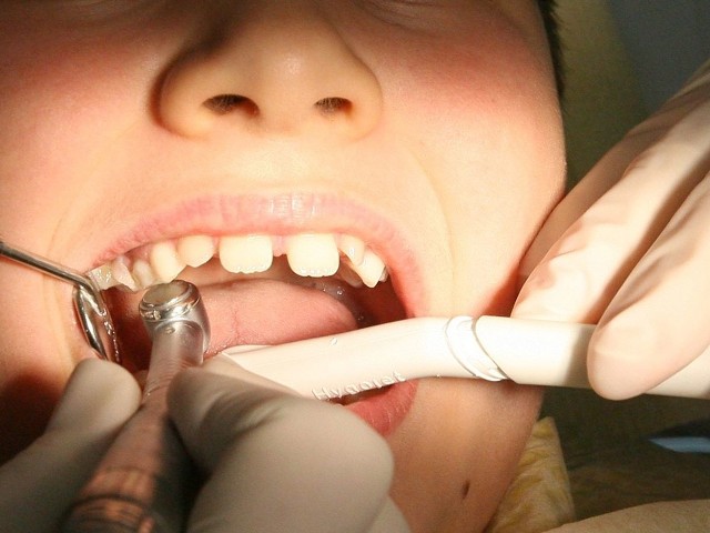 Na Podkarpaciu są tylko 72 gabinety stomatologiczne, specjalizujących się w leczeniu zębów dzieci i młodzieży.