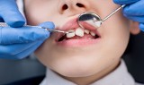 Co przysługuje dzieciom na NFZ u dentysty? Te zabiegi wykonasz u stomatologa bez dodatkowej opłaty