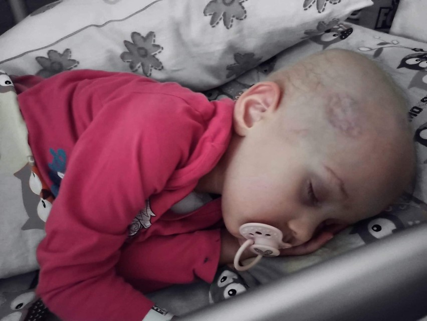 Rodzice walczą o życie dwuletniej Tosi Czarneckiej z Kielc. „Proszę, nie opuszczaj nas” 